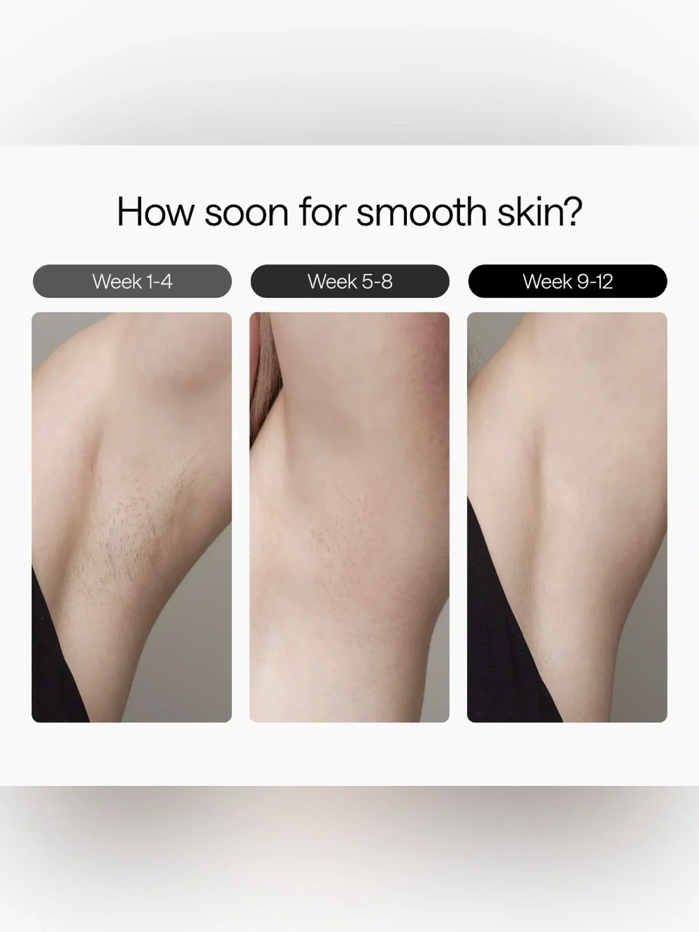 ULIKE Air 3 IPL Hair Removal Device | Sapphire Ice Cooling | Open Box